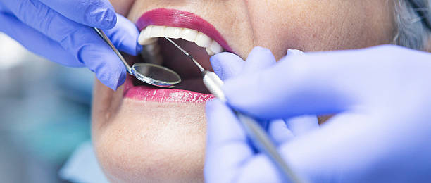 Best Emergency Dental Filling Replacement  in Cross Lanes, WV